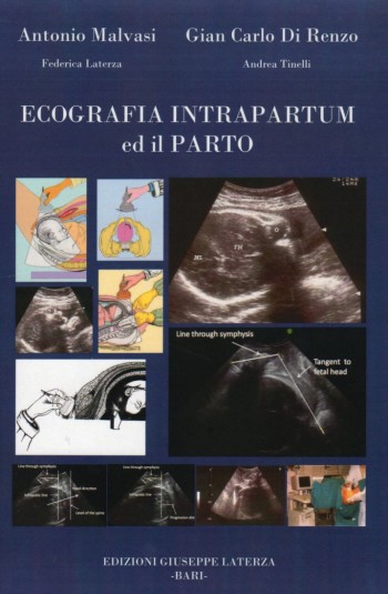 MALVASI Antonio, DI RENZO Gian Carlo, LATERZA Federica, TINELLI Andrea<br />ECOGRAFIA INTRAPARTUM ED IL PARTO