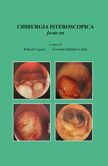 LIGUORI Roberto – LA SALA Giovanni Battista<br />CHIRURGIA ISTEROSCOPICA FOCUS ON